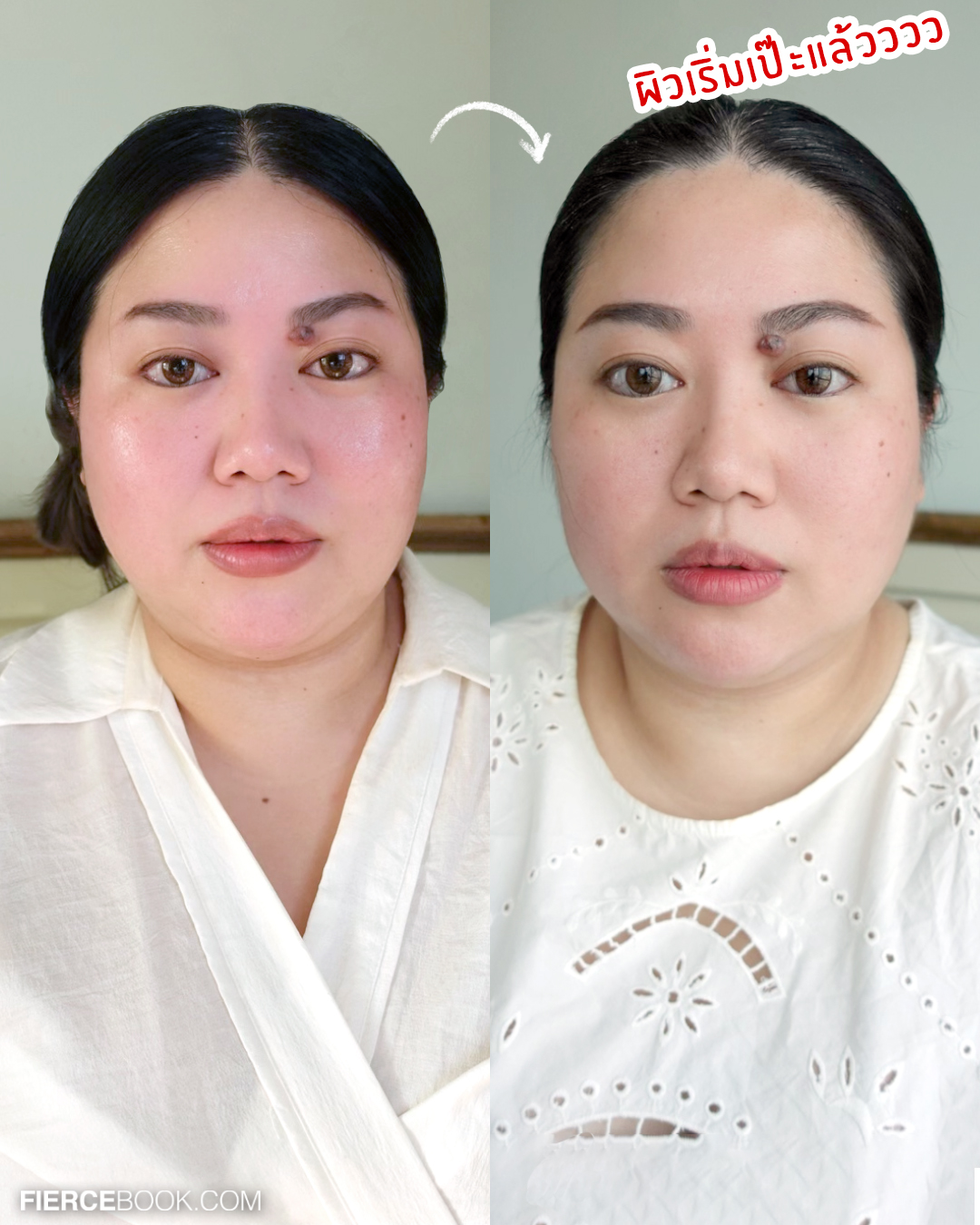 Beauty Review, POND’S Age Miracle Hya VitC Ampoule Serum, พอนด์ส เอจ มิราเคิล ไฮยา วิตซี แอมพูล เซรั่ม, เฟียร์ซป้ายยา, รีวิว, แอมพูล, เซรั่มเข้มข้น, โดสเร่งผิวฟู, บูสต์ผิวด่วน, สวยด่วน, ผิวใส, หน้าใส, ลบเลือนจุดด่างดำ, กระจ่างใส, กู้ผิว, ผิวโกลว, ชุ่มชื้น, ฟู, กระชับ, รูขุมขนเนียน