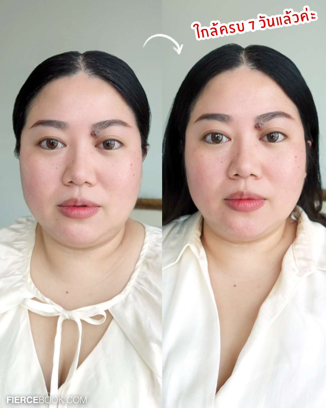 Beauty Review, POND’S Age Miracle Hya VitC Ampoule Serum, พอนด์ส เอจ มิราเคิล ไฮยา วิตซี แอมพูล เซรั่ม, เฟียร์ซป้ายยา, รีวิว, แอมพูล, เซรั่มเข้มข้น, โดสเร่งผิวฟู, บูสต์ผิวด่วน, สวยด่วน, ผิวใส, หน้าใส, ลบเลือนจุดด่างดำ, กระจ่างใส, กู้ผิว, ผิวโกลว, ชุ่มชื้น, ฟู, กระชับ, รูขุมขนเนียน