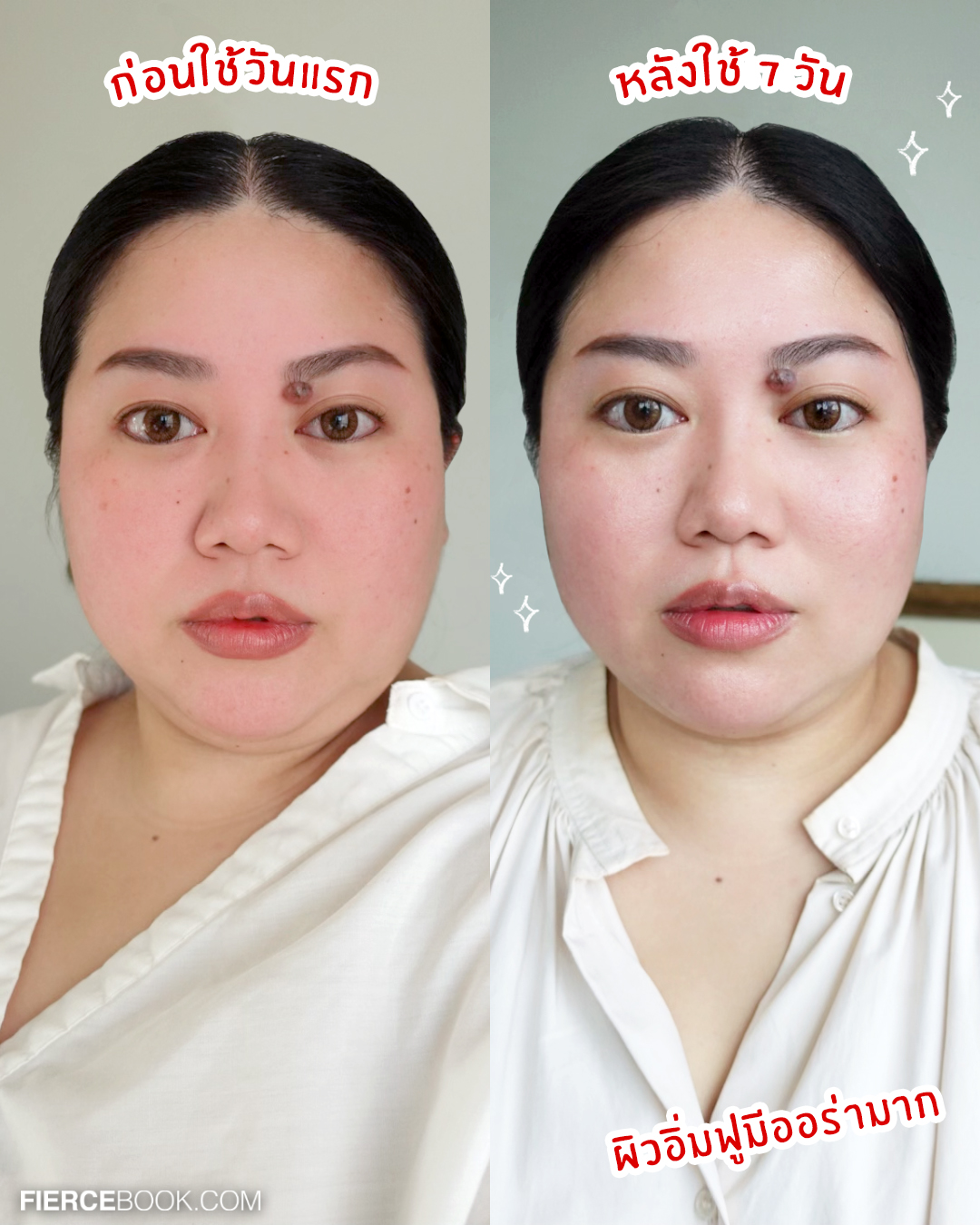 Beauty Review, POND’S Age Miracle Hya VitC Ampoule Serum, พอนด์ส เอจ มิราเคิล ไฮยา วิตซี แอมพูล เซรั่ม, เฟียร์ซป้ายยา, รีวิว, แอมพูล, เซรั่มเข้มข้น, โดสเร่งผิวฟู, บูสต์ผิวด่วน, สวยด่วน, ผิวใส, หน้าใส, ลบเลือนจุดด่างดำ, กระจ่างใส, กู้ผิว, ผิวโกลว, ชุ่มชื้น, ฟู, กระชับ, รูขุมขนเนียน